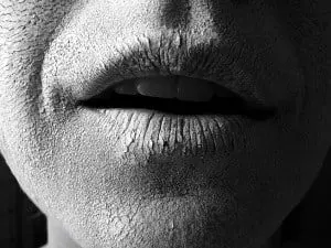 Tips for getting perfect skin