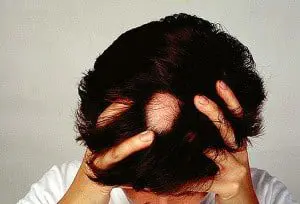 losing your hair