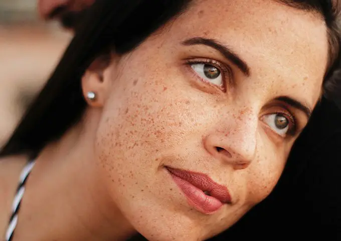 Skin Purging vs. Breakouts: Here’s How To Know The Difference