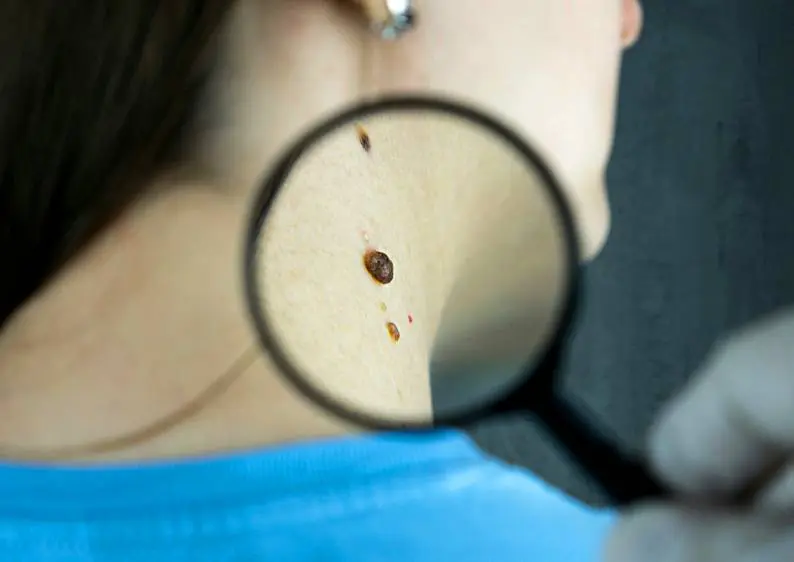 Finding the Right Dermatologist: Essential Tips You Need to Follow