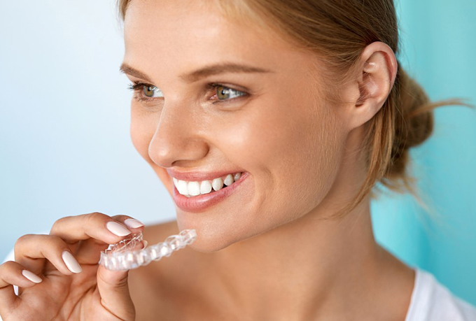 Clear Aligners