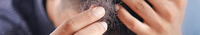 Hair loss treatment methods